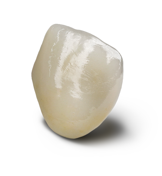 PFZ (Porcelain Fused Zirconia)